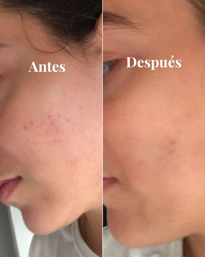 Aufhellendes Serum gegen Hautflecken, 30 ml