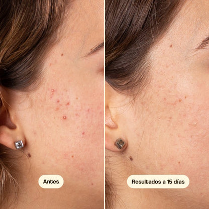 Azelaic Radiance Face Serum Freshly 50 ml